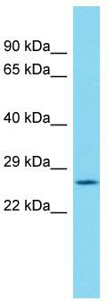 Host: Rabbit; Target Name: C19orf52; Sample Tissue: Plancenta lysates; Antibody Dilution: 1.0 ug/ml.