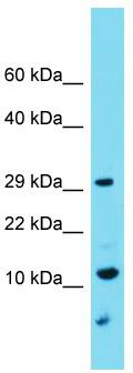 Host: Rabbit; Target Name: C9orf123; Sample Tissue: U937 Whole Cell lysates; Antibody Dilution: 1.0 ug/ml.