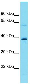 Host: Rabbit; Target Name: CCDC149; Sample Tissue: OVCAR-3 Whole Cell lysates; Antibody Dilution: 1.0 ug/ml.