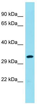 Host: Rabbit; Target Name: R3HDM4; Sample Tissue: MCF7 Whole Cell lysates; Antibody Dilution: 1.0 ug/ml.