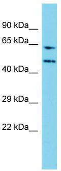 Host: Rabbit; Target Name: WDR85; Sample Tissue: Jurkat Whole Cell lysates; Antibody Dilution: 1.0 ug/ml.