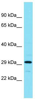 Host: Rabbit; Target Name: ADPRHL1; Sample Tissue: RPMI-8226 Whole Cell lysates; Antibody Dilution: 1.0 ug/ml.