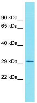 Host: Rabbit; Target Name: GINM1; Sample Tissue: PANC1 Whole Cell lysates; Antibody Dilution: 1.0 ug/ml.
