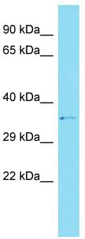Host: Rabbit; Target Name: CCDC159; Sample Tissue: Hela Whole cell lysates; Antibody Dilution: 1.0 ug/ml.