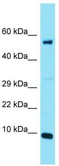Host: Rabbit; Target Name: C20orf166; Sample Tissue: Jurkat Whole Cell lysates; Antibody Dilution: 1.0 ug/ml.