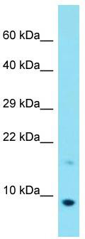 Host: Rabbit; Target Name: C20orf166; Sample Tissue: MCF7 Whole Cell lysates; Antibody Dilution: 1.0 ug/ml.