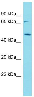 Host: Rabbit; Target Name: C9orf41; Sample Tissue: U937 Whole Cell lysates; Antibody Dilution: 1.0 ug/ml.