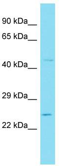 Host: Rabbit; Target Name: WFDC3; Sample Tissue: 721_B Whole Cell lysates; Antibody Dilution: 1.0 ug/ml.