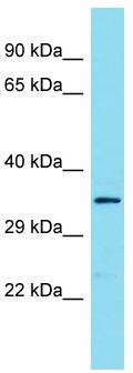 Host: Rabbit; Target Name: C9orf66; Sample Tissue: COLO205 Whole Cell lysates; Antibody Dilution: 1.0 ug/ml