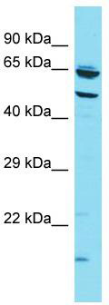 Host: Rabbit; Target Name: CCZ1B; Sample Tissue: HT1080 Whole Cell lysates; Antibody Dilution: 1.0 ug/ml; CCZ1B is strongly supported by BioGPS gene expression data to be expressed in Human HT1080 cells
