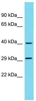Host: Rabbit; Target Name: METAP1D; Sample Tissue: 293T Whole Cell lysates; Antibody Dilution: 1.0 ug/ml