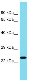 Gel: 12%SDS-PAGE<br>Lysate: 40 μg<br>Lane: Mouse brain tissue lysate<br>Primary antibody: TA365362 (PRNP Antibody) at dilution 1/1200<br>Secondary antibody: Goat anti rabbit IgG at 1/5000 dilution<br>Exposure time: 30 seconds