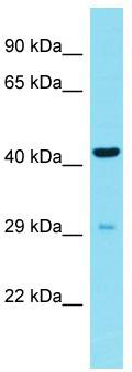 Host: Rabbit; Target Name: CDRT15L2; Sample Tissue: 293T Whole Cell lysates; Antibody Dilution: 1.0 ug/ml