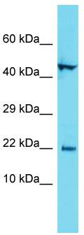 Host: Rabbit; Target Name: C1orf192; Sample Tissue: MCF7 Whole Cell lysates; Antibody Dilution: 1.0 ug/ml