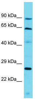 Host: Rabbit; Target Name: CCDC79; Sample Tissue: Jurkat Whole Cell lysates; Antibody Dilution: 1.0 ug/ml
