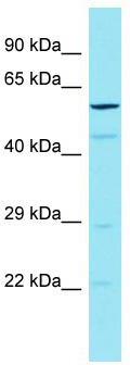 Host: Rabbit; Target Name: CCDC79; Sample Tissue: 293T Whole Cell lysates; Antibody Dilution: 1.0 ug/ml