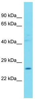 Host: Rabbit; Target Name: C3orf70; Sample Tissue: Placenta lysates; Antibody Dilution: 1.0 ug/ml