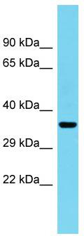 Host: Rabbit; Target Name: C1orf222; Sample Tissue: Fetal Heart lysates; Antibody Dilution: 1.0 ug/ml