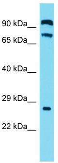 Host: Rabbit; Target Name: C2orf70; Sample Tissue: OVCAR-3 Whole Cell lysates; Antibody Dilution: 1.0 ug/ml