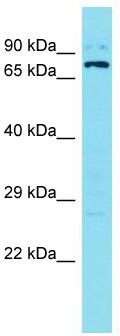 Host: Rabbit; Target Name: SOWAHB; Sample Tissue: 721_B Whole Cell lysates; Antibody Dilution: 1.0 ug/ml