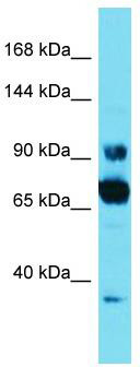 Host: Rabbit; Target Name: CCDC178; Sample Tissue: HT1080 Whole Cell lysates; Antibody Dilution: 1.0 ug/ml