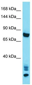 Host: Rabbit; Target Name: ANKRD36; Sample Tissue: HepG2 Whole Cell lysates; Antibody Dilution: 1.0 ug/ml