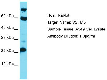 Host: Rabbit; Target Name: VSTM5; Sample Tissue: A549 Whole Cell lysates; Antibody Dilution: 1.0 ug/ml