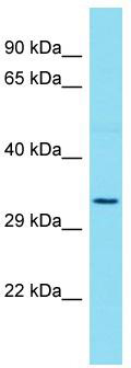 Host: Rabbit; Target Name: OR52D1; Sample Tissue: Hela Whole Cell lysates; Antibody Dilution: 1.0 ug/ml
