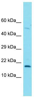 Host: Rabbit; Target Name: C3orf72; Sample Tissue: PANC1 Whole Cell lysates; Antibody Dilution: 1.0 ug/ml