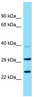 Host: Rabbit; Target Name: C9orf106; Sample Tissue: U937 Whole Cell lysates; Antibody Dilution: 1.0 ug/ml