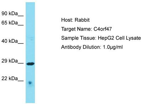 Host: Rabbit; Target Name: C4orf47; Sample Tissue: HepG2 Whole Cell lysates; Antibody Dilution: 1.0 ug/ml