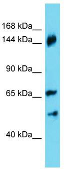 Host: Rabbit; Target Name: ANKRD18B; Sample Tissue: HepG2 Whole Cell lysates; Antibody Dilution: 1.0 ug/ml