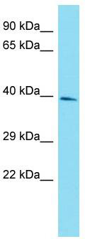 Host: Rabbit; Target Name: RBMXL1; Sample Tissue: HepG2 Whole Cell lysates; Antibody Dilution: 1.0 ug/ml