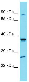 Host: Rabbit; Target Name: SLC35G4; Sample Tissue: HepG2 Whole Cell lysates; Antibody Dilution: 1.0 ug/ml