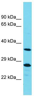 Host: Rabbit; Target Name: PTPN20A; Sample Tissue: MCF7 Whole Cell lysates; Antibody Dilution: 1.0 ug/ml