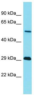 Gel: 8%SDS-PAGE<br>Lysate: 40 μg<br>Lane 1-2: A172 and TM4 cell lysates<br>Primary antibody: TA366420 (MYEF2 Antibody) at dilution 1/800<br>Secondary antibody: Goat anti rabbit IgG at 1/5000 dilution<br>Exposure time: 4 minutes