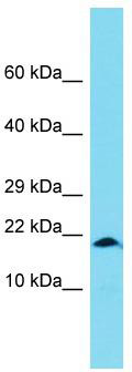 Host: Rabbit; Target Name: XAGE1B; Sample Tissue: OVCAR-3 Whole Cell lysates; Antibody Dilution: 1.0 ug/ml