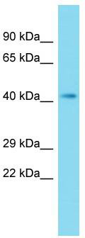 Host: Rabbit; Target Name: CNPPD1; Sample Tissue: Fetal Liver lysates; Antibody Dilution: 1.0 ug/ml
