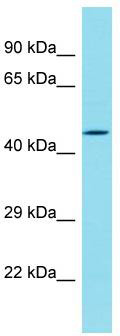 Host: Rabbit; Target Name: DBF4B; Sample Tissue: Hela Whole Cell lysates; Antibody Dilution: 1.0 ug/ml