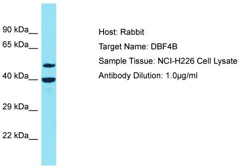 Host: Rabbit; Target Name: DBF4B; Sample Tissue: NCI-H226 Whole Cell lysates; Antibody Dilution: 1.0 ug/ml