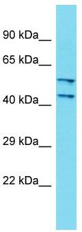 Host: Rabbit; Target Name: DCAF4L2; Sample Tissue: Fetal Kidney lysates; Antibody Dilution: 1.0 ug/ml