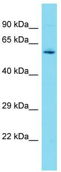 Host: Rabbit; Target Name: DCAF10; Sample Tissue: HepG2 Whole Cell lysates; Antibody Dilution: 1.0 ug/ml