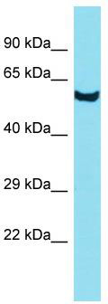 Host: Rabbit; Target Name: DUS3L; Sample Tissue: PANC1 Whole Cell lysates; Antibody Dilution: 1.0 ug/ml