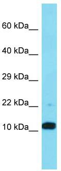 Host: Rabbit; Target Name: FAM25A; Sample Tissue: Jurkat Whole Cell lysates; Antibody Dilution: 1.0 ug/ml