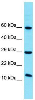 Host: Rabbit; Target Name: FAM32A; Sample Tissue: HCT15 Whole Cell lysates; Antibody Dilution: 1.0 ug/ml. FAM32A is supported by BioGPS gene expression data to be expressed in HCT15