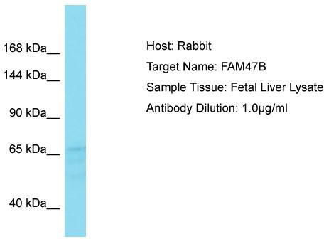 Host: Rabbit; Target Name: FAM47B; Sample Tissue: Fetal Liver lysates; Antibody Dilution: 1.0 ug/ml