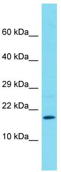 Host: Rabbit; Target Name: FAM183B; Sample Tissue: Placenta lysates; Antibody Dilution: 1.0 ug/ml