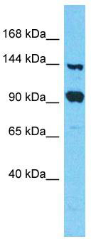 Host: Rabbit; Target Name: FAM193A; Sample Tissue: 293T Whole Cell lysates; Antibody Dilution: 1.0 ug/m. lFAM193A is supported by BioGPS gene expression data to be expressed in HEK293T