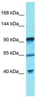 Host: Rabbit; Target Name: FGD5; Sample Tissue: U937 Whole Cell lysates; Antibody Dilution: 1.0 ug/ml