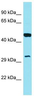 Host: Rabbit; Target Name: GOLPH3L; Sample Tissue: MCF7 Whole Cell lysates; Antibody Dilution: 1.0 ug/ml GOLPH3L is supported by BioGPS gene expression data to be expressed in MCF7
